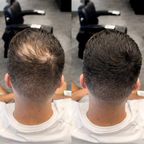 Polvo Capilar Rellenador